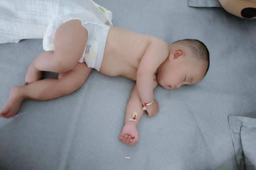 安丘宝宝脸上有白色斑块